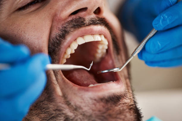 Full Mouth Reconstruction in Mulino, OR
